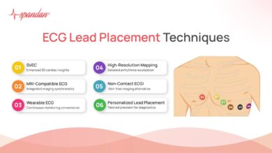leads for ekg