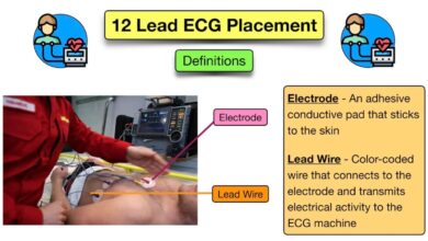 leads on ecg